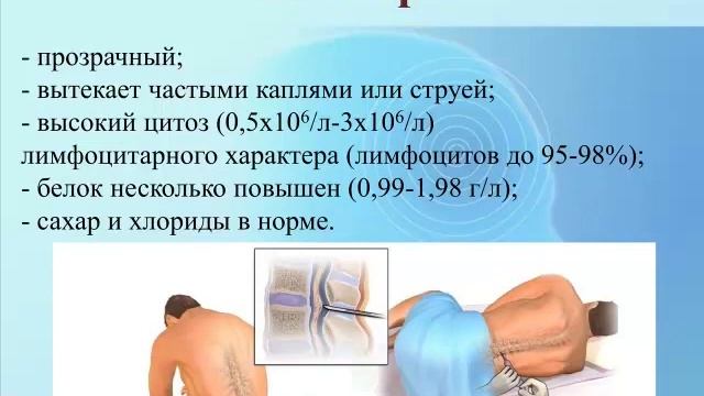 Паротитная инфекция смотреть онлайн