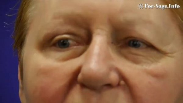 Полная презентация Ageless | результаты применения | отзывы гостей