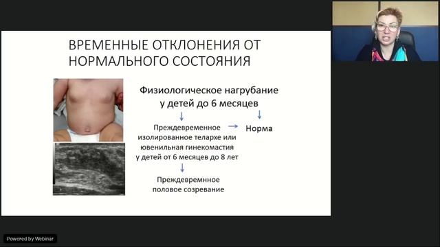 Молочная железа в различные периоды жизни женщины. Часть 1 смотреть онлайн
