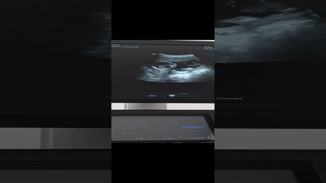 VID_20220222_131705.mp4