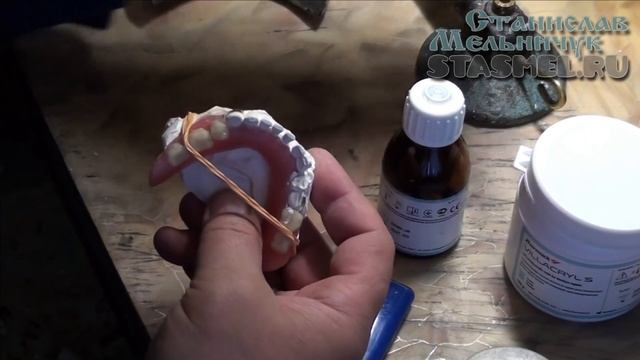 ЗУБНЫЕ ПРОТЕЗЫ. Приварка нового кламмера взамен сломавшегося обломившегося. смотреть онлайн