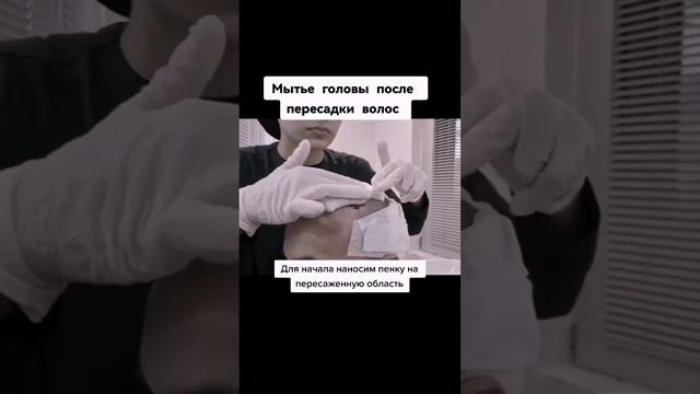 Пересадка волос в Турции | Мытье головы после пересадки волос