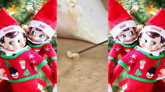 Blackheads Milia Big Cystic Acne Blackheads Extraction Whiteheads Removal Pimple Popping#439 смотреть онлайн