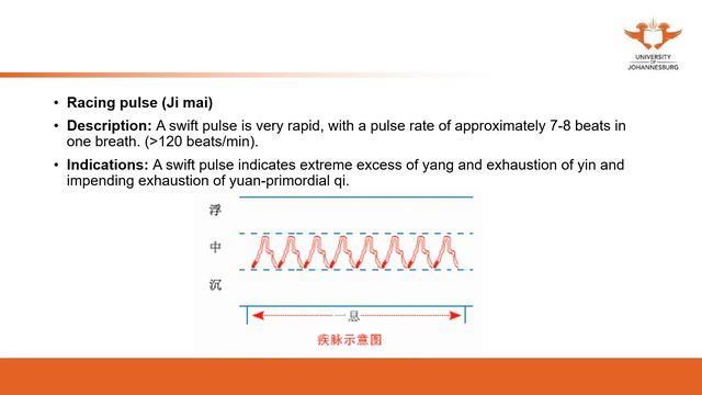 201. UJ online lectures:40 Diagnostics Pulse Diagnosis 4 Slow,Rapid Pulse смотреть онлайн