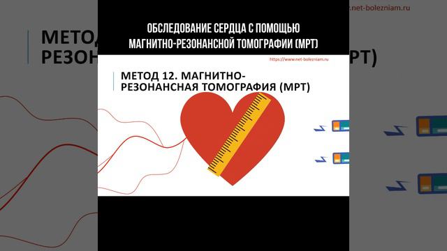 Обследование сердца с помощью магнитной резонансной томографии (МРТ) #сердце #мрт #томография смотреть онлайн