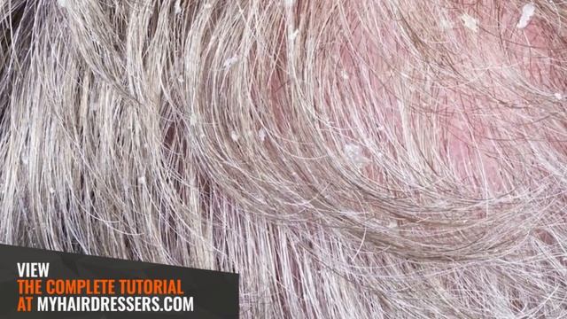 HAIR SCIENCE - INFECTIOUS DISEASES