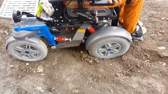 Тест Otto Bock c2000 смотреть онлайн