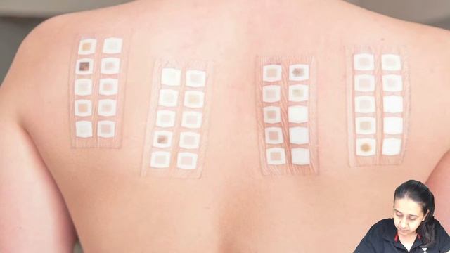 FMGE Dec 2022 | Must know MCQs in Dermatology | Dr. Chesta Agarwal смотреть онлайн
