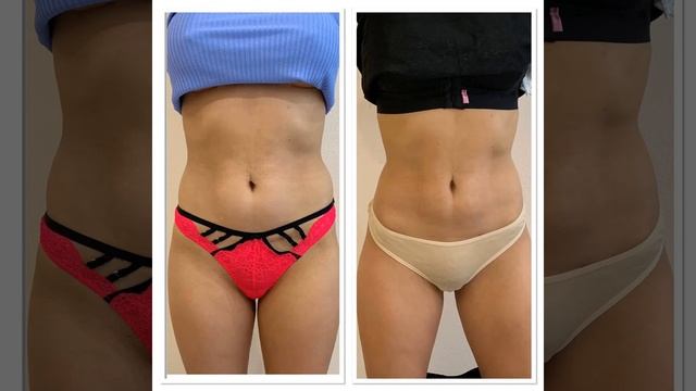 ?Идеальная фигура быстро и качественно Краснодар. ? +7-918-347-20-68