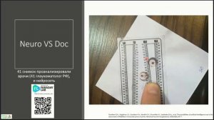 Нюансы тонометри  Часть 2  Эластотонометрия