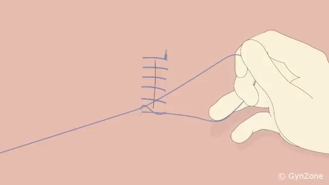Surgical skills: Self-locking finishing knot / Aberdeen knot смотреть онлайн
