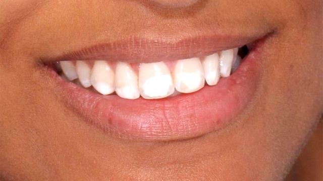 Какую зубную пасту выбрать? На что обратить внимание! смотреть онлайн