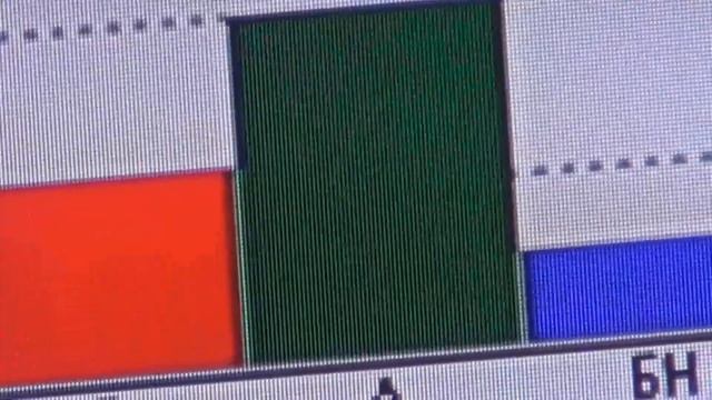 Дистантное воздействия миллиметровых волн. BioTrEM в стрессогенных ситуациях. смотреть онлайн