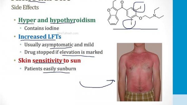 Cardiology - 4. Arrhythmias - 6.Antiarrhythmic Drugs atf