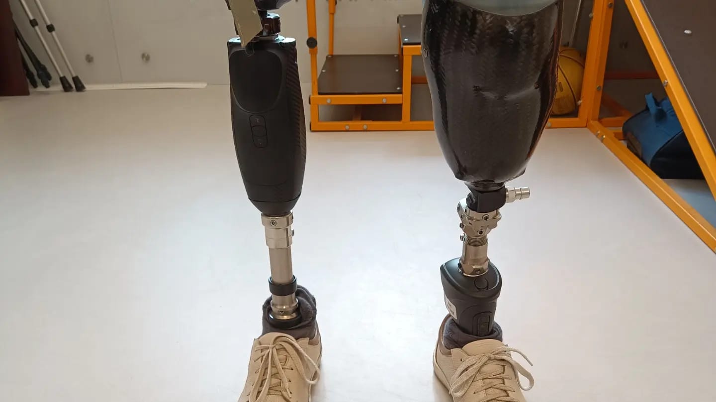 Протезы ног: Микропроцессорная стопа и микропроцессорный коленный модуль. смотреть онлайн