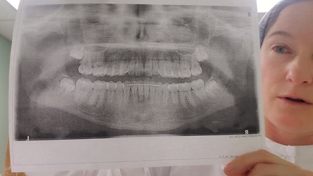 О рентгеновских снимках смотреть онлайн