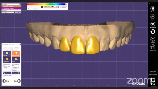 Exocad Mockup Morphology