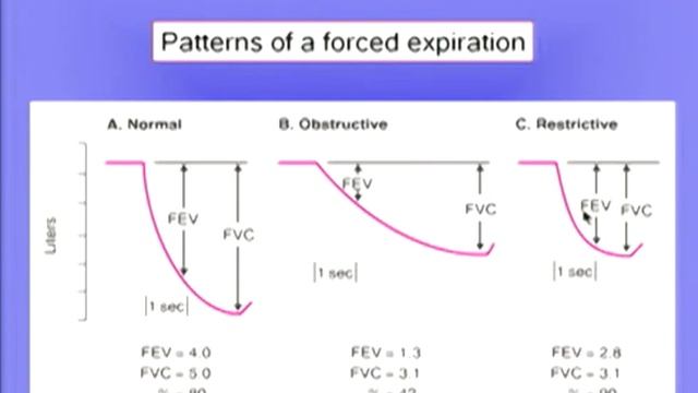Restrictive Diseases