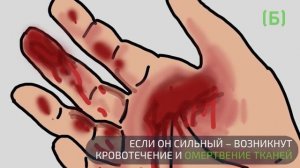 Что будет, если засунуть пальцы в розетку