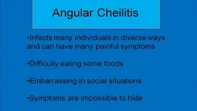 Angular Cheilitis Natural Cure - Free Forever! смотреть онлайн