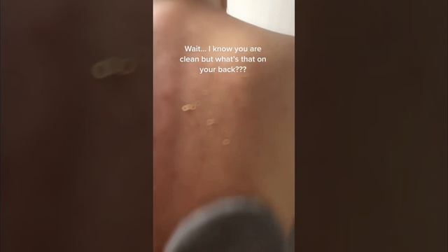 Monyè Co. Exfoliating Mitt Removes Dead Skin In Seconds смотреть онлайн