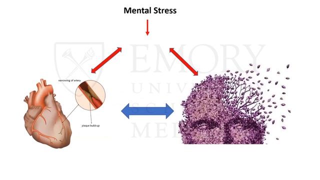 Mental Stress and Cognitive Function in Coronary Artery Disease смотреть онлайн