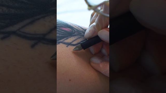 Как происходит процесс электроэпиляции ⚡️#лазернаяэпиляция #депиляция #электроэпиляция #косметология смотреть онлайн