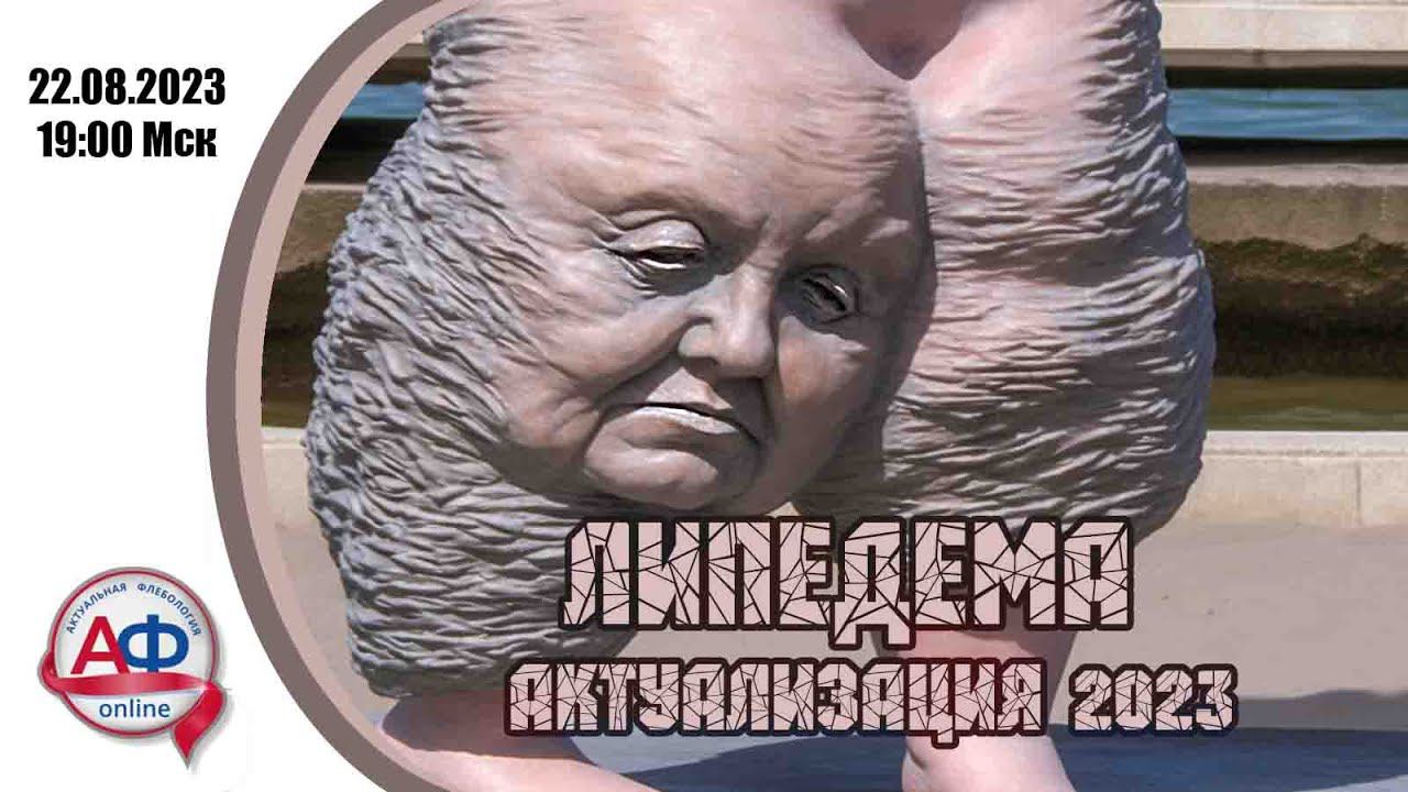 Липедема 2023 смотреть онлайн