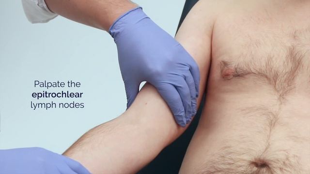 Lymphoreticular Examination - OSCE Guide (lymph node, spleen and liver examination) смотреть онлайн