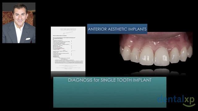 Digital Workflow for Anterior Implant Aesthetics смотреть онлайн