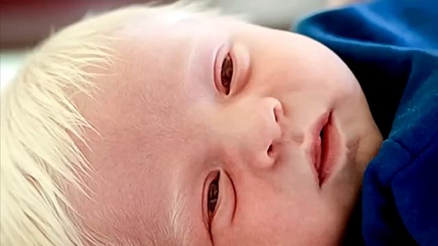 У врачей пропал дар речи, когда они увидели, что у него на голове! смотреть онлайн