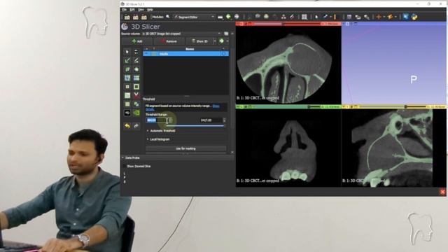 3D Segmentation Workshop - Dicom to STL model using 3D slicer смотреть онлайн