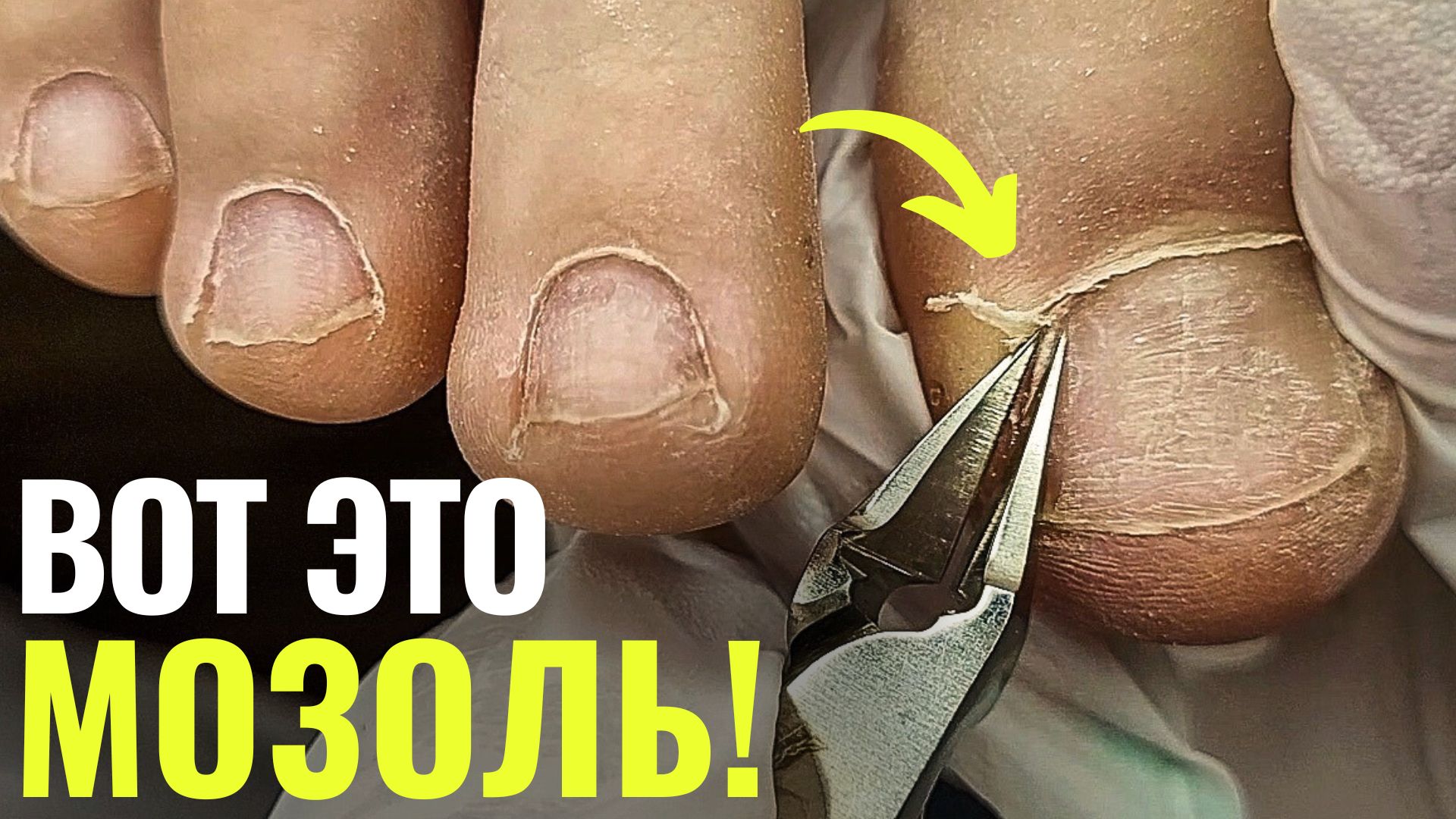УСТАЛА МУЧАТЬСЯ!😫ПОДРОБНО про ПЕДИКЮР для новичков! смотреть онлайн