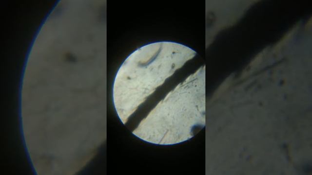 Голова таракана под микроскопом при увеличение от 100 до900 смотреть онлайн