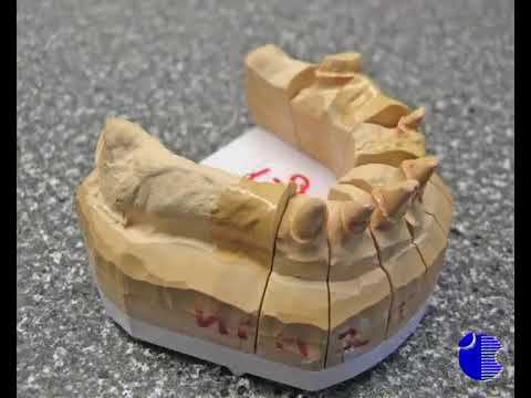 Этапы изготовления бюгельных протезов часть 1 смотреть онлайн