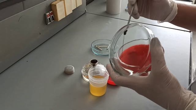 Посев мочи методом Голда смотреть онлайн