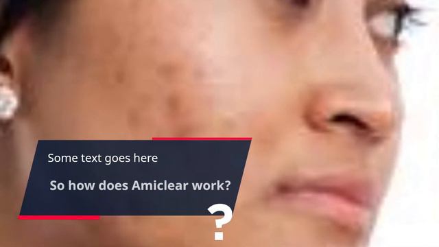 "Discover the Ultimate Deal on Amiclear - Unlock the Best Price Today!" смотреть онлайн