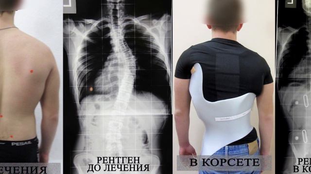 Диалог у озера | Татьяна Могилянцева смотреть онлайн