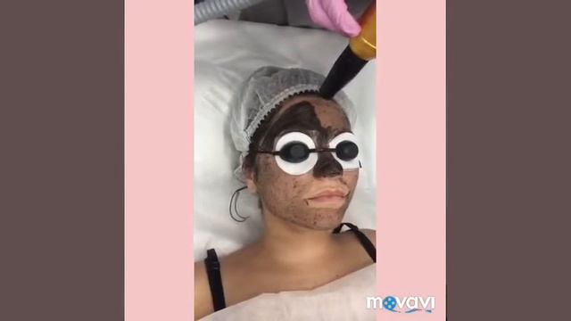 Карбоновый Лазерный пилинг От и До смотреть онлайн