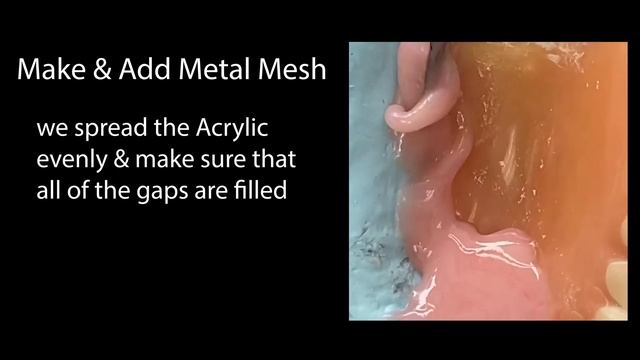 How to Repair a Broken Denture in 25 Minutes смотреть онлайн