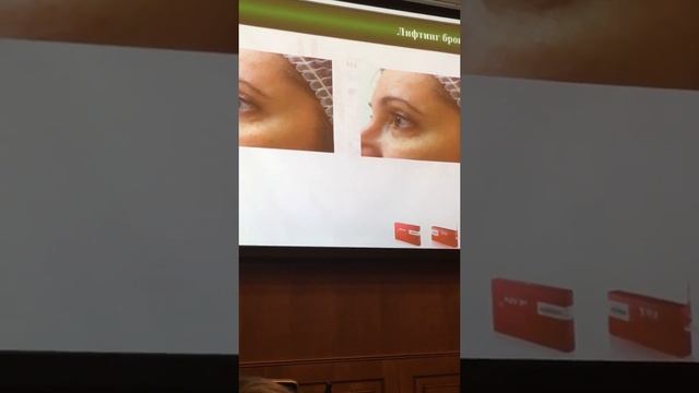 Диспорт конференция смотреть онлайн