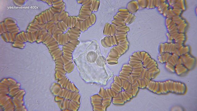 Что такое кровь простыми словами - Кровь под микроскопом смотреть онлайн