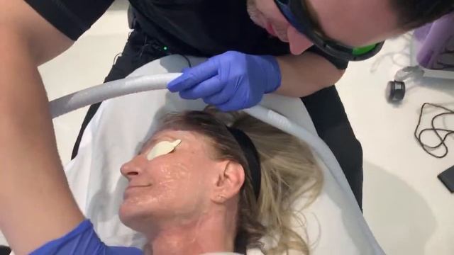 Intense Pulsed Light (IPL) Photo-Facial | Skin Rejuvenation | West Hollywood, CA | Dr. Jason Emer смотреть онлайн