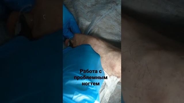 Вышло новое видео! Мужской педикюр и работа с проблемным ногтем! смотреть онлайн