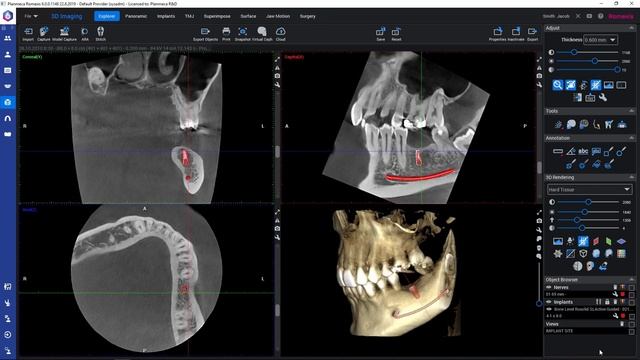 Romexis How To: Import a cbct image in dicom multiframe format смотреть онлайн