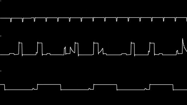 Blipblop Memories composed by !cube (Atari ST YM2149F) Oscilloscope смотреть онлайн