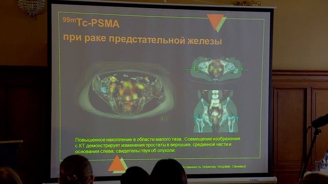 Сухов В.Ю. — Дальнейшее развитие ОФЭКТ/КТ смотреть онлайн