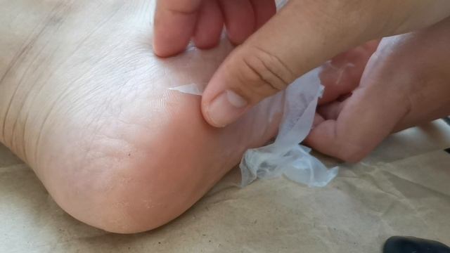 #35 Mystery Guest's Insaaaane Satisying Foot Peeling Video ????? смотреть онлайн