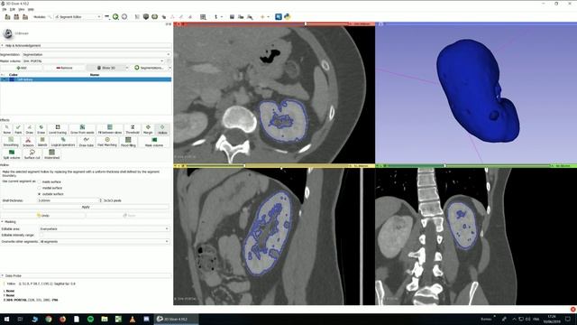 Basics 2: 3D Slicer Basic Tools