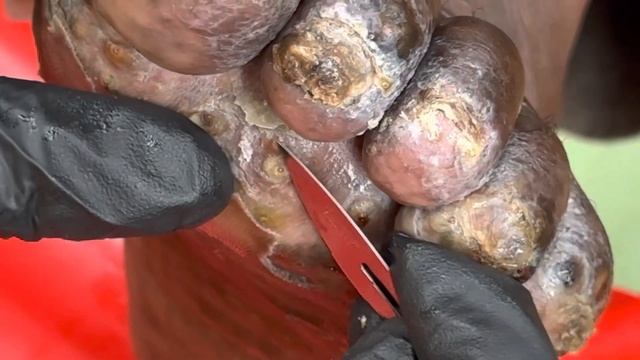 Jigger Digging Jackson's Left Foot For The Very Last Time - Watch Full Video @riseupsociety.net